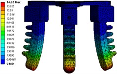 Simulation parameters of a finger under negative air pressure.