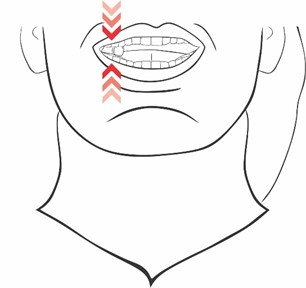 Alternate unilateral chewing, 3 minutes 3x a day, chew the hyperboloid from one side to the other