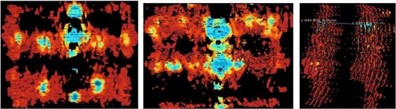 Images of experimentally collected data at different distances from the field model (left middle  right indicates the distance between the front, back, and front and rear panels, respectively)