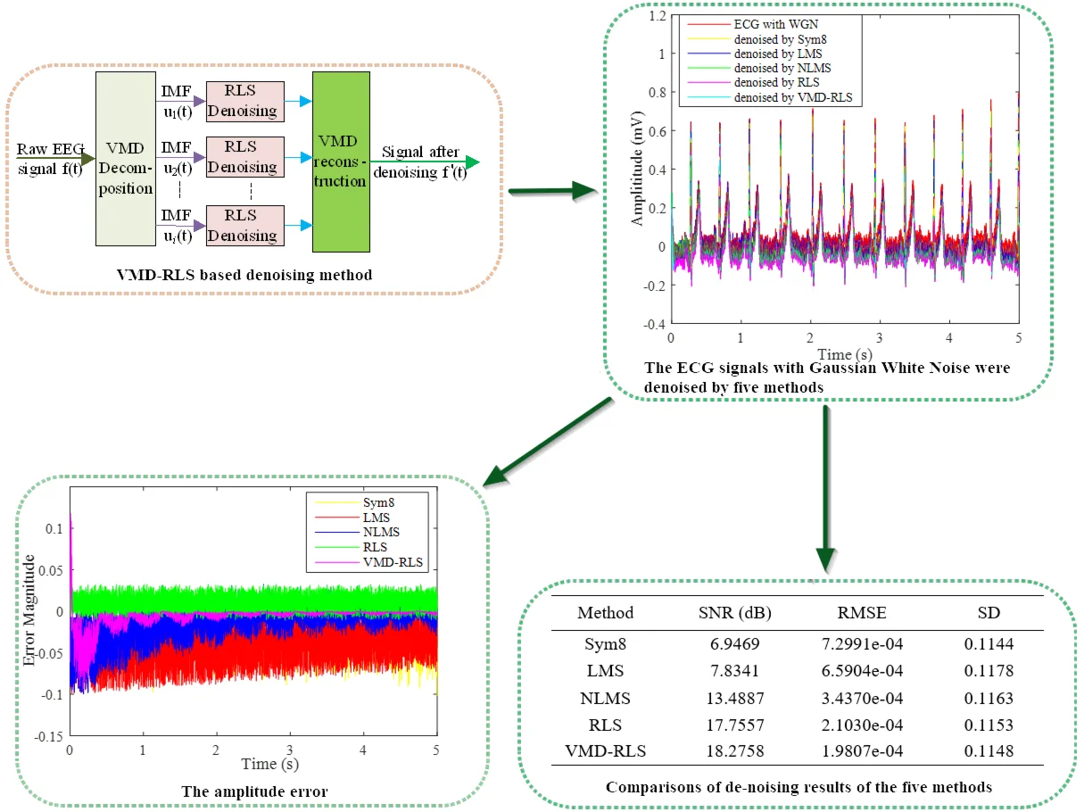 Denoising for ECG signals based on VMD and RLS