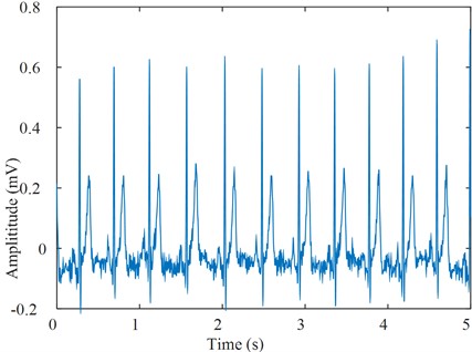 The ECG signal without noise