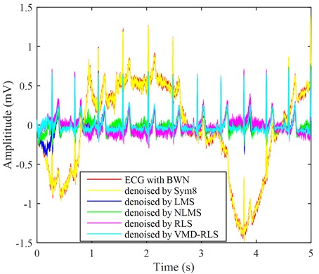 The ECG signals with baseline wander noise were denoised by four methods