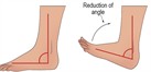 DOFs, bones, and joint movements of the lower body in the sagittal plane