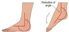 DOFs, bones, and joint movements of the lower body in the sagittal plane