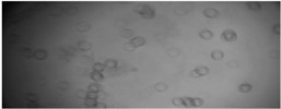 Visual representation of different phases in MWFs: a) droplets of oil in the fluid emulsion. Mag 20×0.40×4, wd1.4; b) metal parts in emulsion, Mag 20×0.40×2, wd 10.4, c) contaminations in emulsion Mag 20×0.40×1.5, wd 10.4
