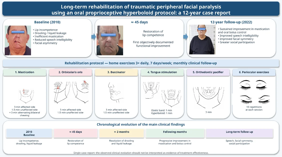 Long-term rehabilitation of traumatic peripheral facial paralysis using an oral proprioceptive hyperboloid protocol: a 12-year case report