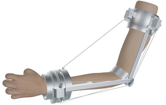 Design of a rehabilitation exoskeleton  for the elbow joint