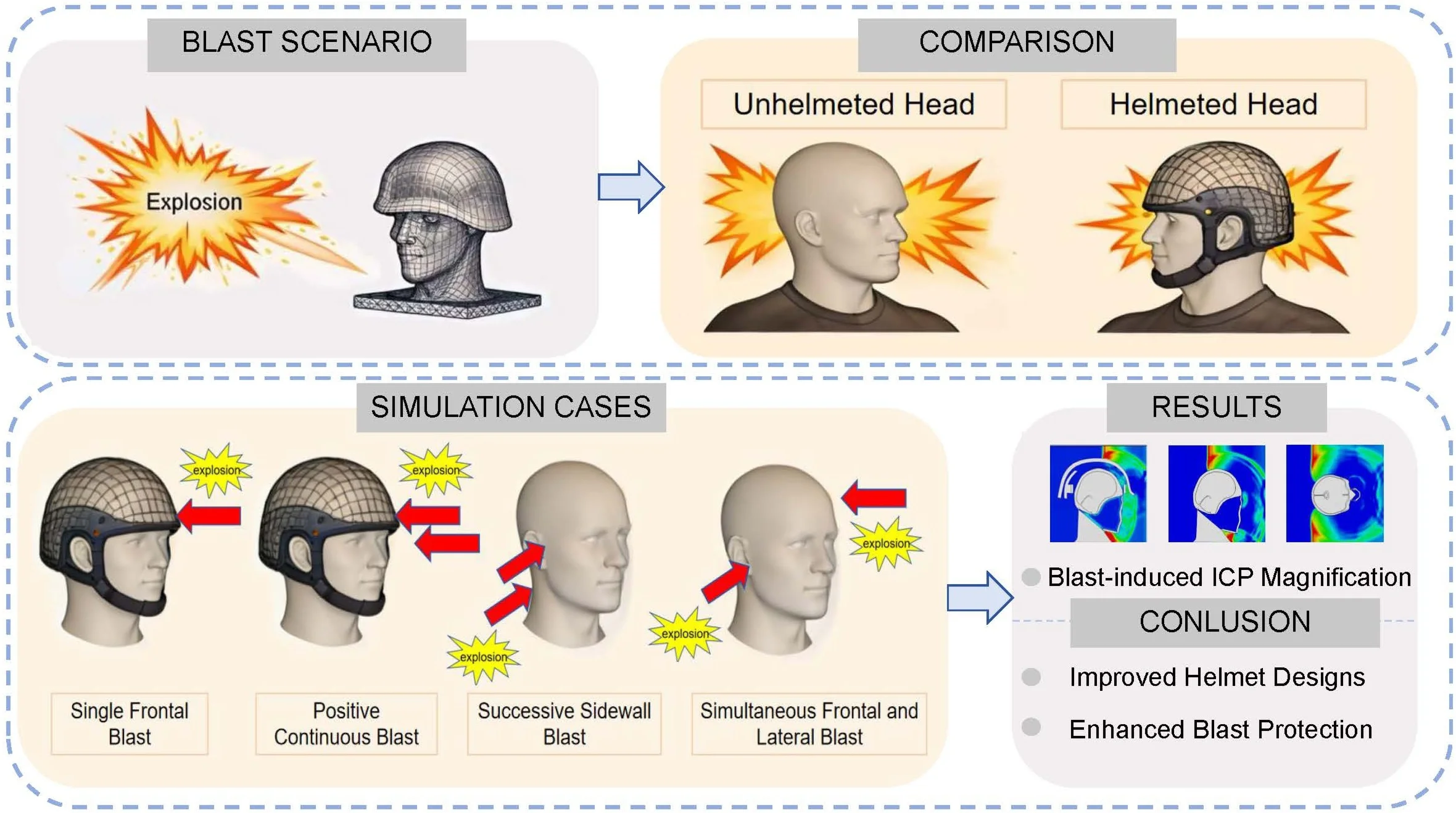 Study on craniocerebral dynamic response and helmet protection performance under accompanying shock wave