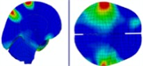Intracranial pressure distribution of continuous lateral impact