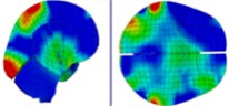 Intracranial pressure distribution of continuous lateral impact