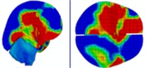 Intracranial pressure distribution of continuous lateral impact