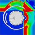 Pressure distribution of synchronous frontal side impact while wearing a helmet