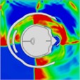 Pressure distribution of synchronous frontal side impact while wearing a helmet