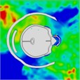 Pressure distribution of synchronous frontal side impact while wearing a helmet