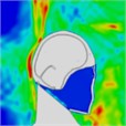 Pressure distribution of synchronous frontal side impact without wearing a helmet