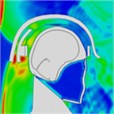 Pressure distribution of a single frontal impact on the head while wearing a helmet