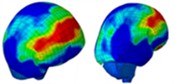 Distribution of intracranial pressure in a single frontal impact