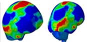 Distribution of intracranial pressure in a single frontal impact