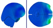 Distribution of intracranial pressure during continuous frontal impact