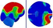 Distribution of intracranial pressure during continuous frontal impact