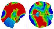 Distribution of intracranial pressure during continuous frontal impact