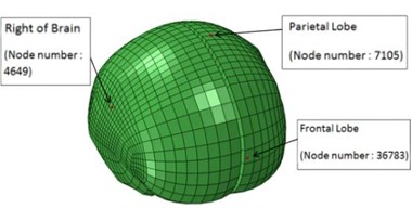 Location of nodes at the brain where intracranial pressure is measured