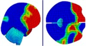 Distribution of intracranial pressure during continuous frontal impact