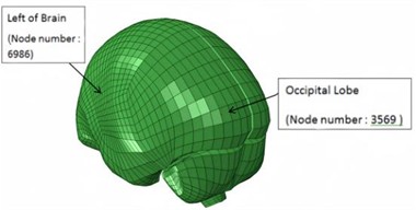 Location of nodes at the brain where intracranial pressure is measured