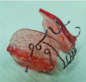 a) Design of the CPB: 1 – coffin spring, that can be constructed with the curvature for anterior  or posterior, depending on the necessity of each case, the position in the palate can also vary  depending on the transversal gain necessity; 2 – acrilic internal shield, 3 – posterior stabilizer,  4 – anterior stabilizer, 5 – curved wave bar to guide the position of the tongue, it can come  from superior down if the tongue is pressuring more superior and can come from inferior  up if the tongue is pressuring more inferior; b) real model of CPB