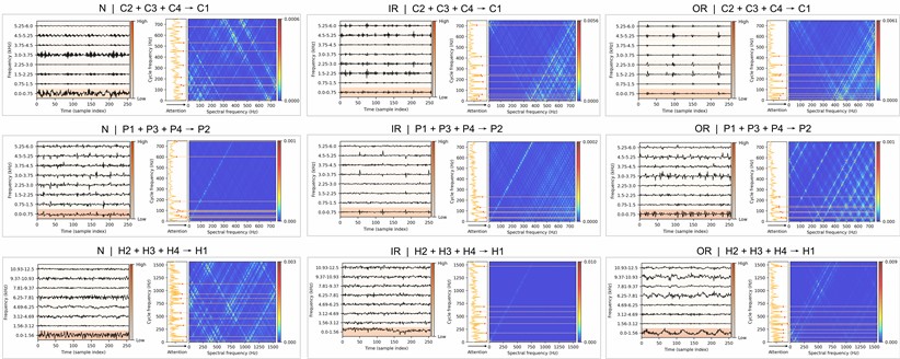 Exemplary attention maps of three health states (columns) in three cases (rows)