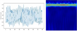 Vibration signals and their time–frequency images of different fault types