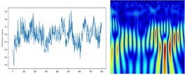 Vibration signals and their time–frequency images of different fault types