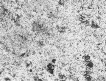 Microstructure after carbonitriding. Photo taken by M.Z. Ubaydullaev (co-author) in the laboratory of the Almalyk Branch of NUST MISIS, 2025