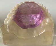 Polymerized resins, in blue before treatment and in lilac, after treatment