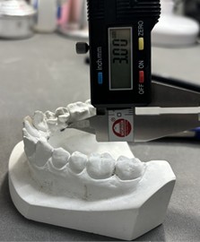 Measuring and limiting the lower part: 3 mm below the free marginal gingiva of the premolars