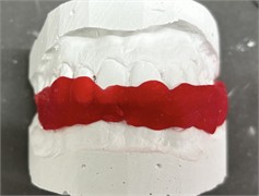 a) Articulated models; b) wax used to seal the resin exit; c) resin inserted into the previously isolated and hydrated model