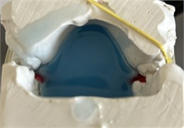 a) Articulated models; b) wax used to seal the resin exit; c) resin inserted into the previously isolated and hydrated model