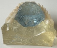 Polymerized resins, in blue before treatment and in lilac, after treatment