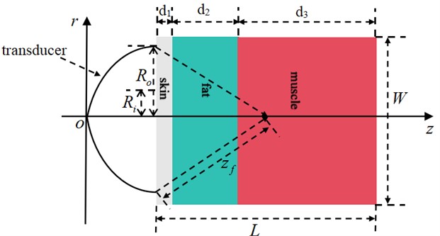 A multilayer biological tissue model exposed to HIFU radiation