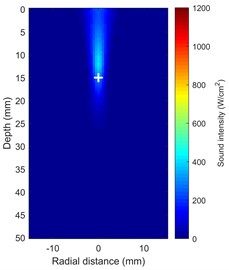Shows how the temperature and acoustic field change over time during HIFU therapy a), b) maps of the distribution of acoustic intensity, with a maximum acoustic intensity of 1000 W/cm2, clearly show  how concentrated the HIFU energy is in the focal region (depth ~15 mm); c) temperature field  distribution at t = 5 s; d) temperature field distribution at t = 20 s  (Notes: + marks the HIFU focal point, and dashed lines represent tissue boundaries)