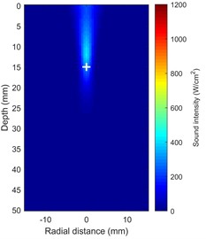 Shows how the temperature and acoustic field change over time during HIFU therapy a), b) maps of the distribution of acoustic intensity, with a maximum acoustic intensity of 1000 W/cm2, clearly show  how concentrated the HIFU energy is in the focal region (depth ~15 mm); c) temperature field  distribution at t = 5 s; d) temperature field distribution at t = 20 s  (Notes: + marks the HIFU focal point, and dashed lines represent tissue boundaries)