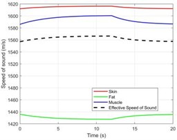 Performance evaluation of the dual-frequency phase difference thermometry method. a) The “theoretical temperature” progression curve at the focal center (r = 0, z = 15 mm) shows the heating process over a complete 20 seconds. Eventually, the temperature rises exponentially and gets closer to thermal equilibrium. At 20 seconds, the temperature at the focal center reaches its maximum of 35.3 °C,  or 72.3 °C, in absolute terms. b) The change in sound speed (Δc) at the focal point in the muscle layer  (z =15 mm) and the deepest point in the fat layer (z = 11.9 mm) with time along the central axis (r = 0). It is clear that the fat layer causes a negative shift in sound speed. c) The response curve for dual-frequency phase differences, which shows a significant connection with temperature change (R2 = 0.993).  d) The calibration connection between temperature and phase difference exhibits good linearity.  e)–f) A comparison of the temperature reconstruction results from the two methods. g) The temperature measurement error distribution illustrates the significant advantage of the dual-frequency technique.  h) The single-frequency and dual-frequency phase responses are examined when the tissue undergoes a step-like axial displacement ΔL = 1 μm. Compared to the single-frequency method, the dual-frequency method is only 22.2 % as sensitive to motion interference as the single-frequency method. i) A quantitative analysis of overall performance shows a 99.1 % increase in accuracy