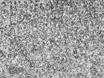 Ferrite-Pearlite Microstructure of Steel 45 After Normalization (×200). Photo by the authors in the laboratory of the Almalyk Branch of NUST MISIS 2026