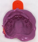 Laboratory procedure: a) the working models mounted on the articulator; b)-c) after building the direct tracks with modelling wax; d)-e) duplication and cast model; f) mock-up acetate trays made on duplicated model