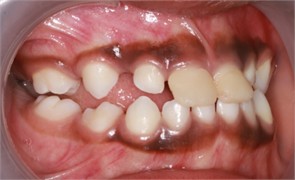 a)-c) Follow-up pictures on day 13, d)-g) Follow-up pictures after 3 months