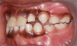 a)-c) Follow-up pictures on day 13, d)-g) Follow-up pictures after 3 months
