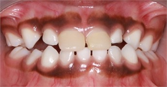 a)-c) Follow-up pictures on day 13, d)-g) Follow-up pictures after 3 months