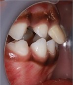 a)-c) Follow-up pictures on day 13, d)-g) Follow-up pictures after 3 months