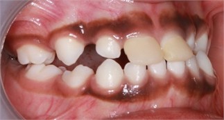 a)-c) Follow-up pictures on day 13, d)-g) Follow-up pictures after 3 months