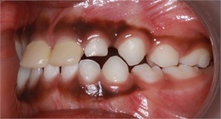 a)-c) Follow-up pictures on day 13, d)-g) Follow-up pictures after 3 months